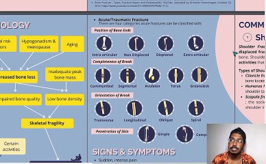 Fracture - Disease Awareness Video Presentation
