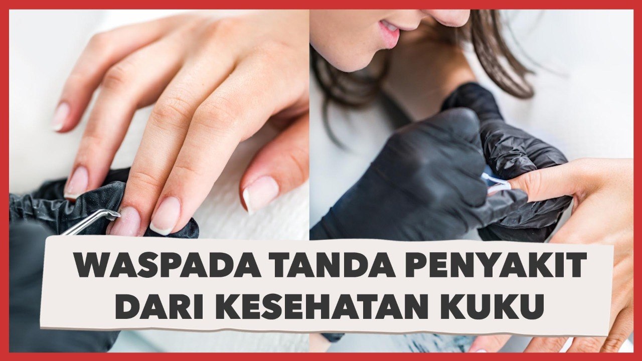 Jangan Sepelehkan! Waspada Tanda Penyakit dari Kesehatan Kuku
