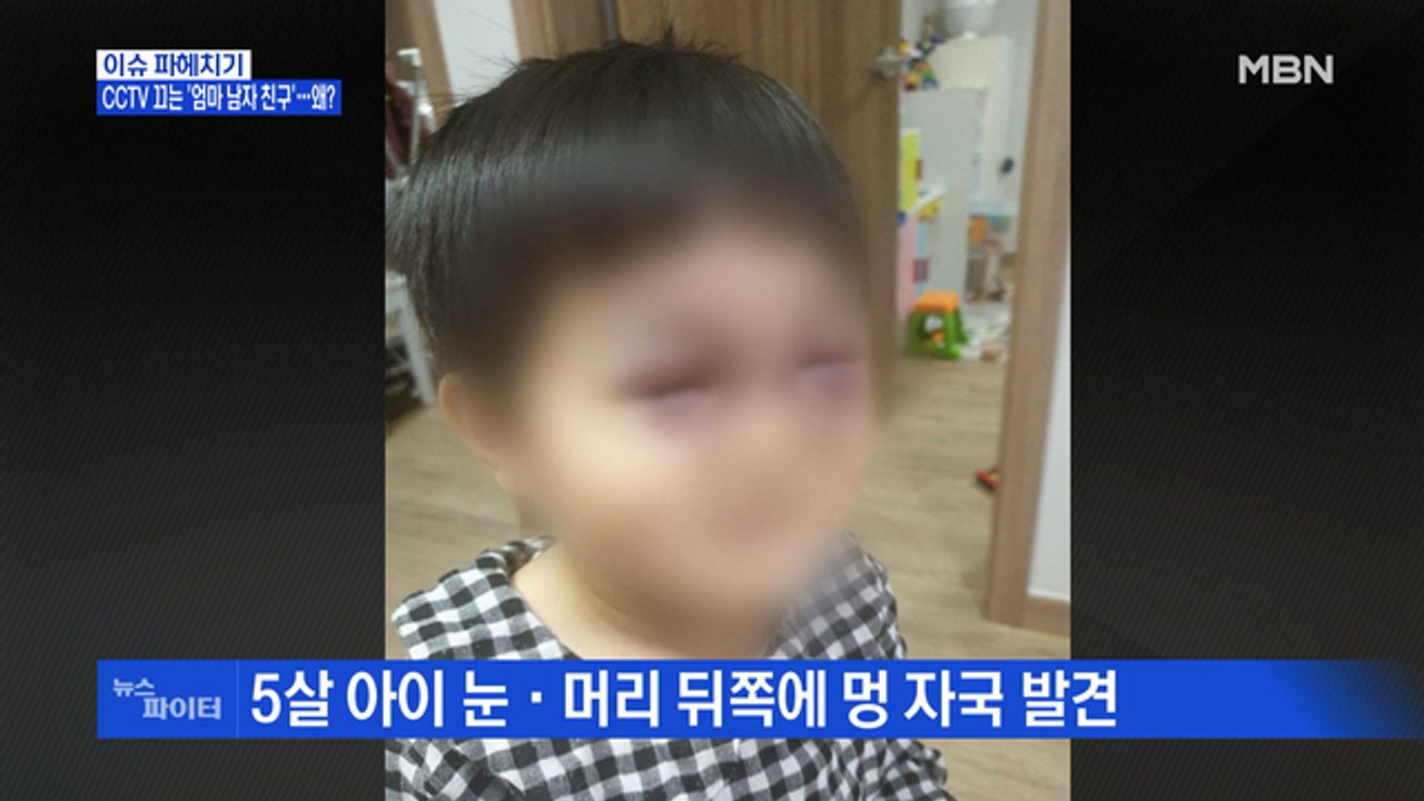MBN 뉴스파이터-5살 아이 얼굴에 피멍…CCTV 끄는 '엄마 남자친구'?
