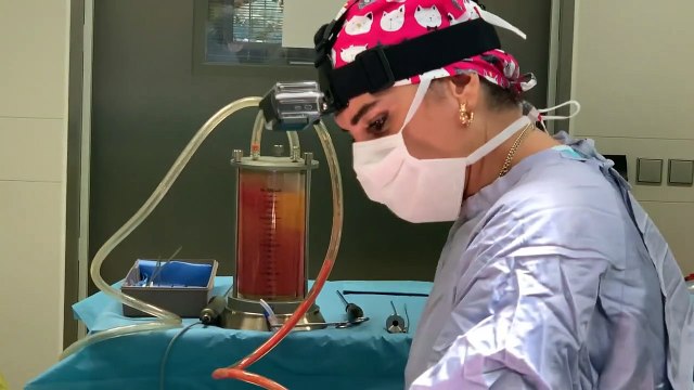 Yağ Aldırma | Vaser Liposuction (Liposakşın) Ameliyatı | Önce&Sonra Sonuçları