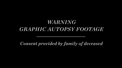 The Alienist - Featurette The Dying Art of the Autopsy (English) HD