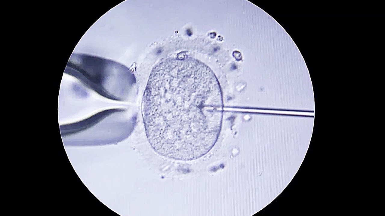 Baby Ã  la Carte - Trailer (Deutsch) HD