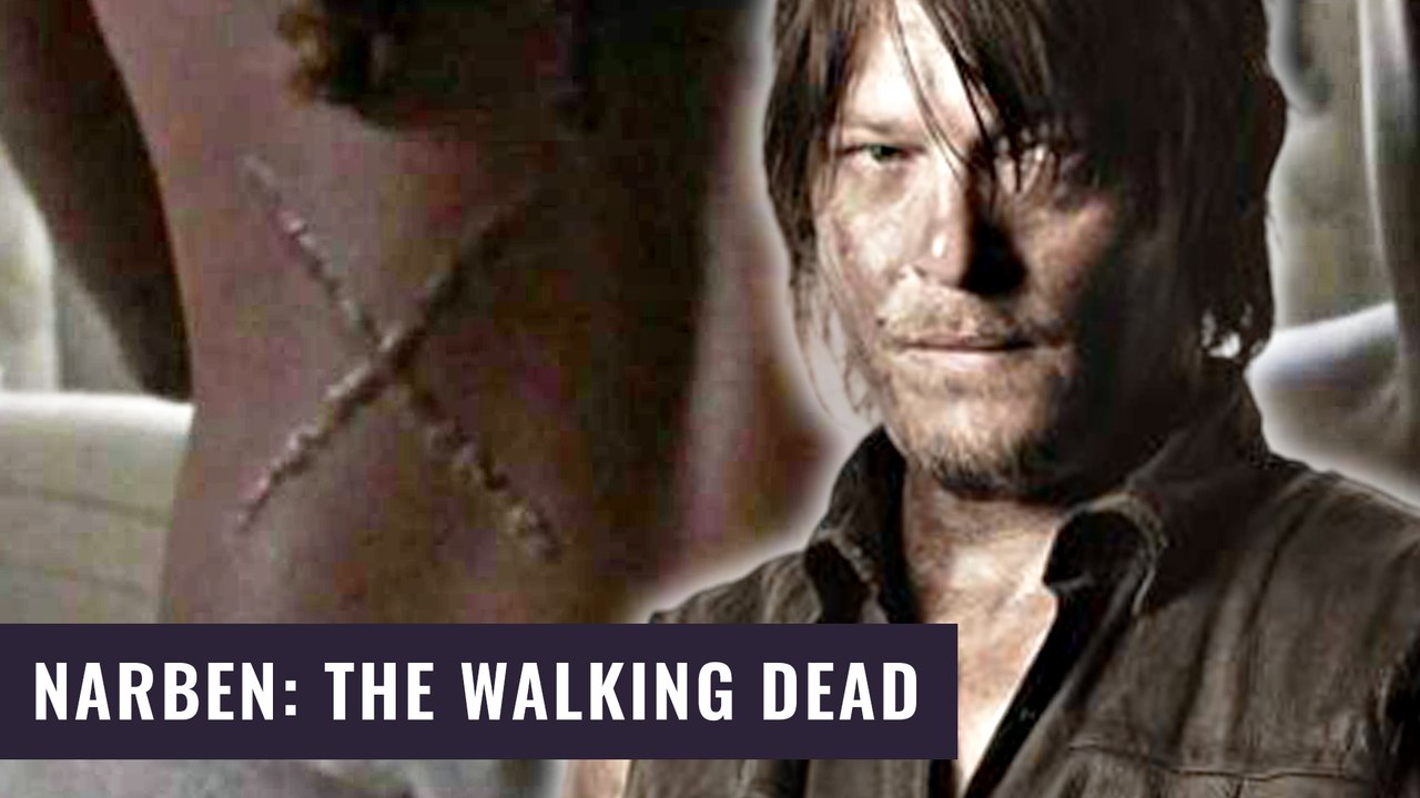 The Walking Dead: Der Ursprung der Narben ist gelÃ¼ftet! | Alle Easter Eggs aus 9x14