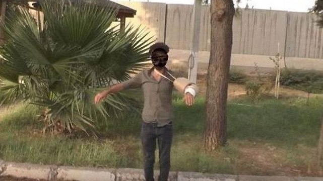 Yakalanan terörist bombayı kolundaki alçıya saklamış