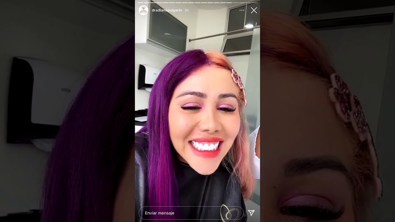 Con un diamante en sus dientes, Yina Calderón estrenó diseño de sonrisa