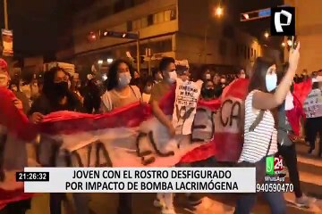 Joven quedó con el rostro desfigurado tras ser impactado por bomba lacrimógena durante marcha