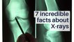 7 incredible facts about X-rays