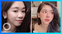 Gadis 19 tahun lakukan operasi plastik setelah putus dengan pacar - TomoNews