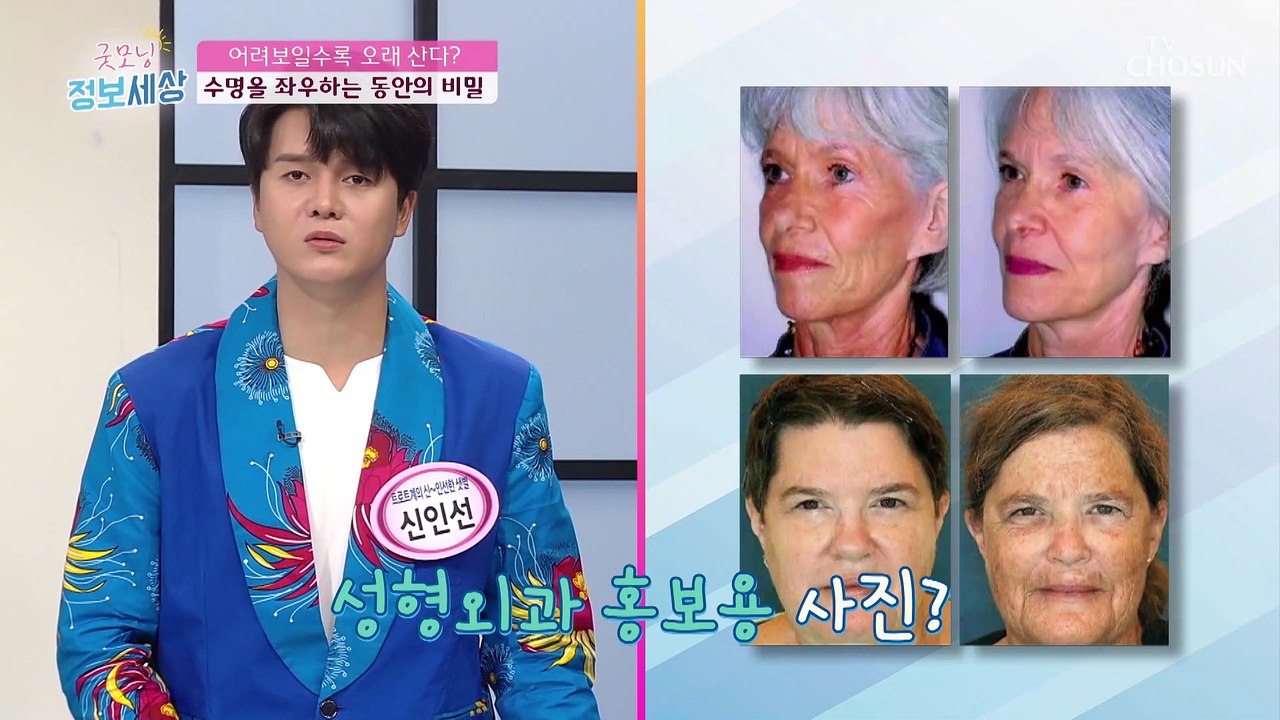 동안이 오래 산다? 수명을 좌우하는 노화 #광고포함