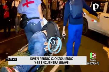 Piden ayuda para joven que perdió un ojo y que tiene el cráneo perforado tras asistir a las marchas