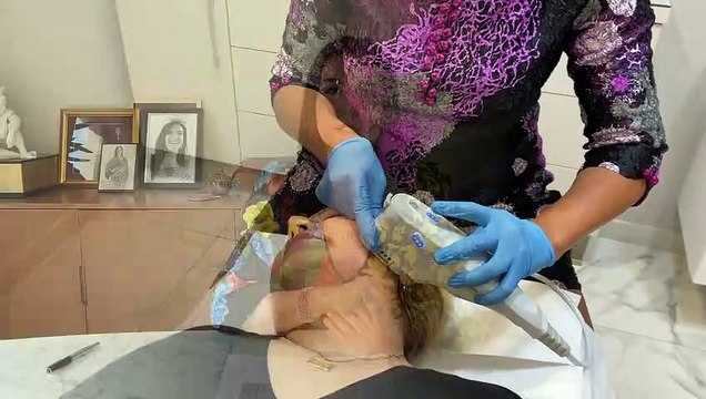 Suna Dumankaya, Ulthera uygulaması ile zamanın izlerini sildik! _ Ameliyatsız Cilt Gençleştirme