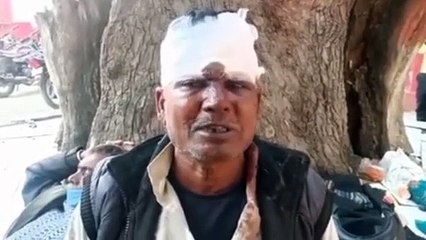 बुजुर्ग ससुर को गुंडे दमाद ने जमकर पीट कर किया घायल, अस्पताल में इलाज जारी