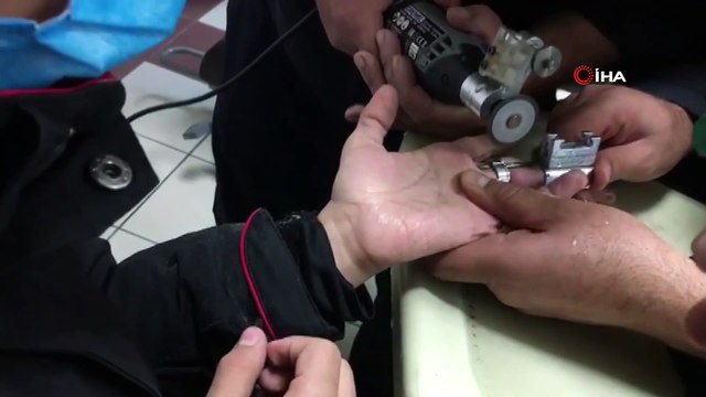 İtfaiyeden yüzük operasyonu: Parmağı kangren olmadan kurtarıldı