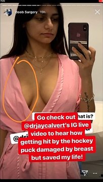 Beverly Hills Plastic Surgery Podcast - Mia-Khalifa surgery after being hit by hockey puck