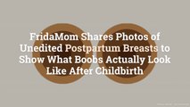 FridaMom Shares Photos of Unedited Postpartum Breasts to Show What Boobs Actually Look Lik