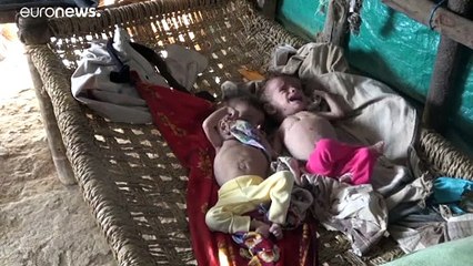 فيديو.. حربٌ ونزوحٌ وسوءُ تغذية يعانيها توأمان يمنيان لم يتجاوزا 18 شهراً