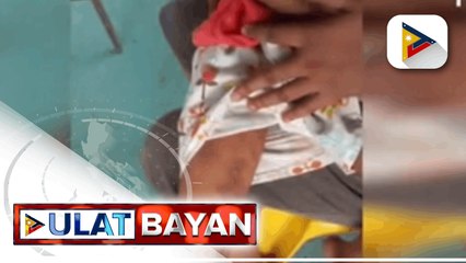 7-anyos PWD sa Bulacan, dinatnan ng kanyang lola na puro pasa at sugat