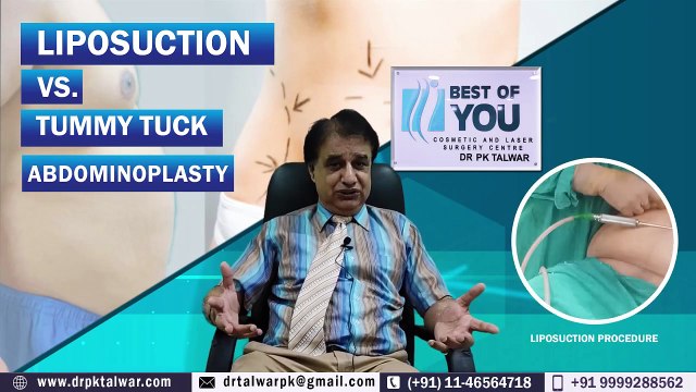 Fat Removal Surgery _ Liposuction Vs. Tummy Tuck Which is Best for me Know by Cosmetic Surgeon Dr. PK Talwar