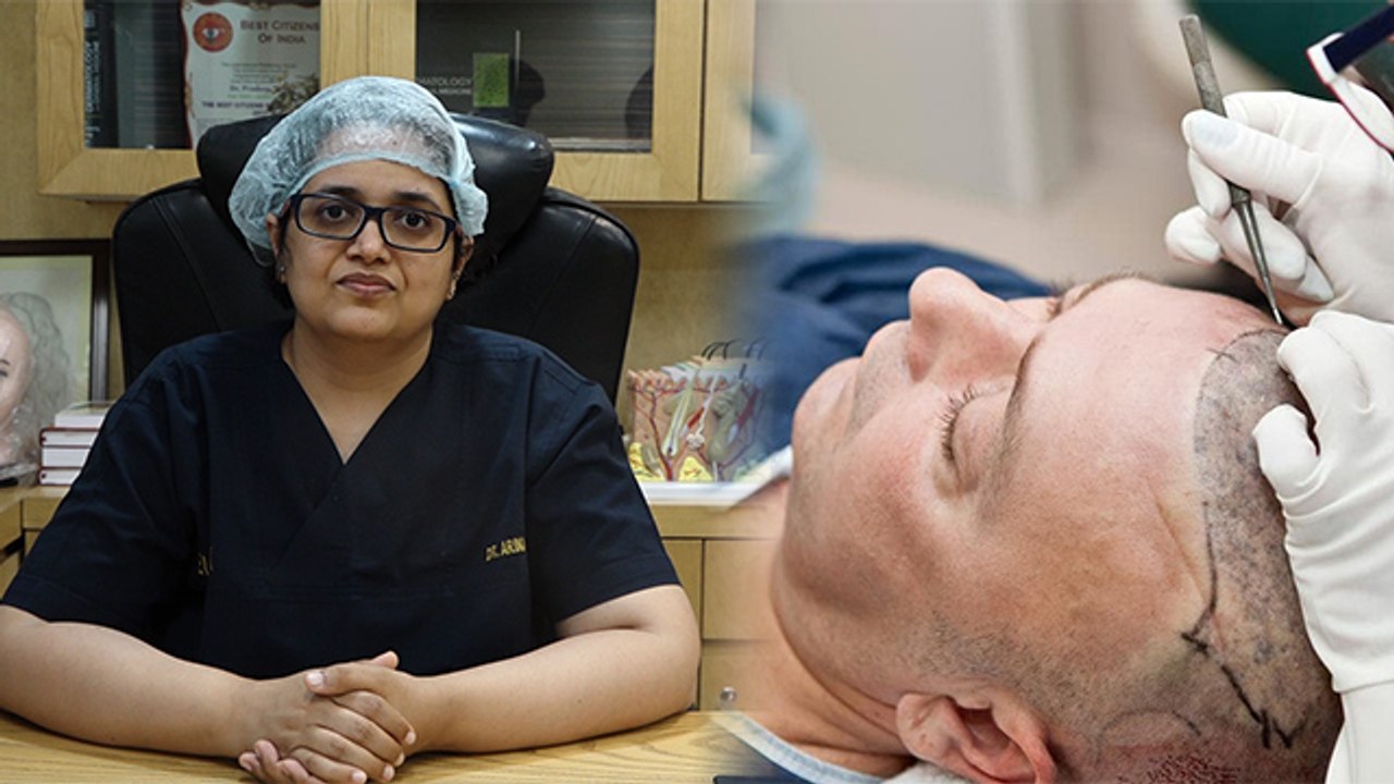 Hair Transplant Procedures | आप भी कराने जा रहे...