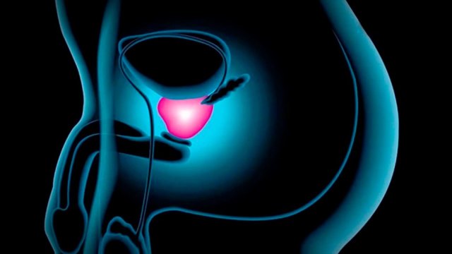 bd-tratamientos-para-problemas-de-prostata-y-tumores-de-testiculares-251120