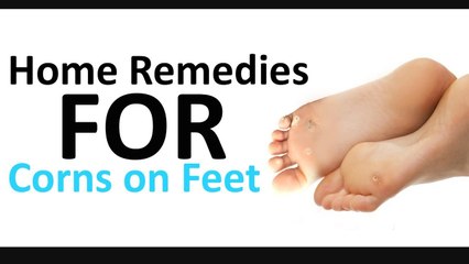 Home Remedies for Corns on Feet | Shah Nazir | Herbalist
