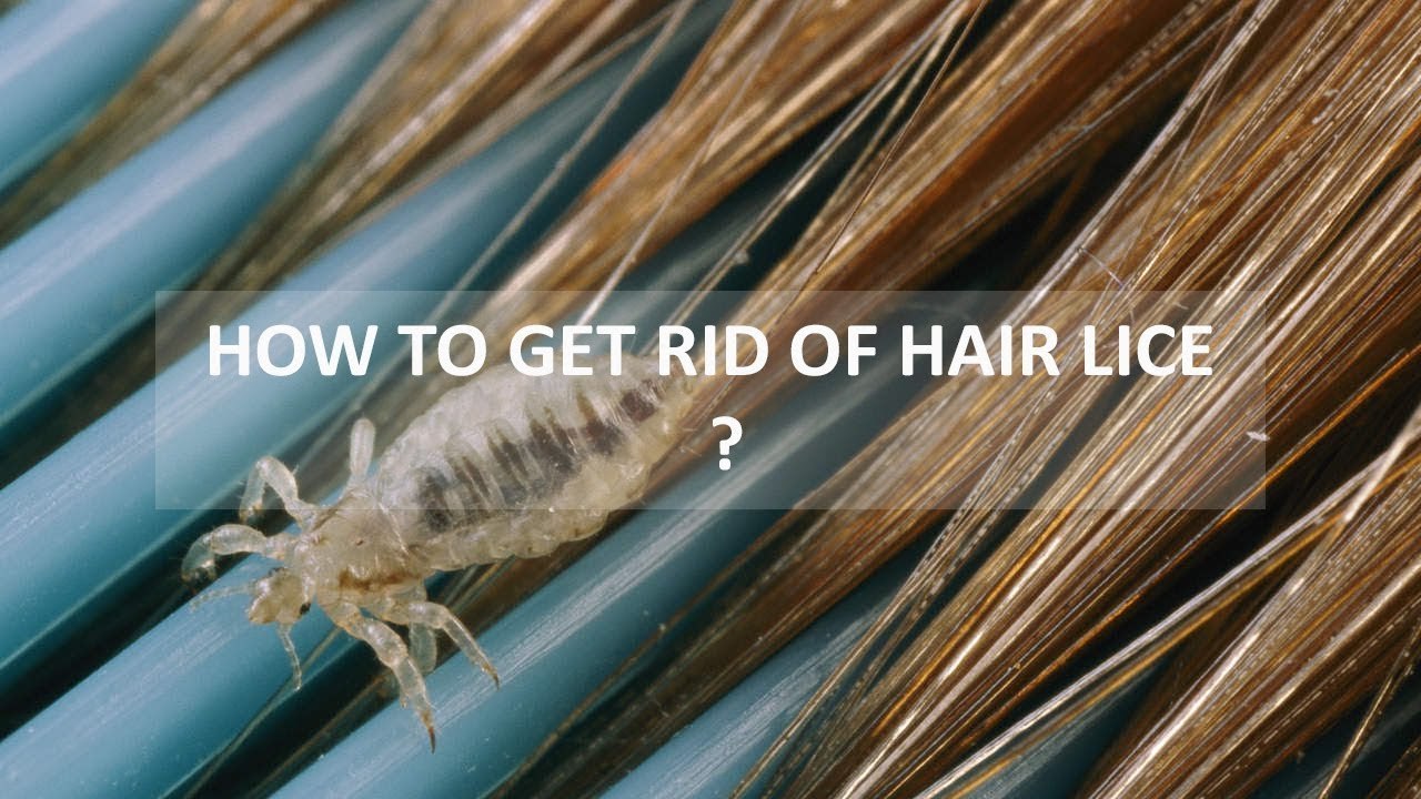 How to Get Rid of Hair Lice | Shah Nazir | Herbalist | Health Tips