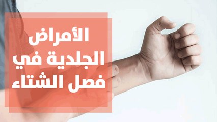 الأمراض الجلدية في فصل الشتاء الأكثر انتشاراً