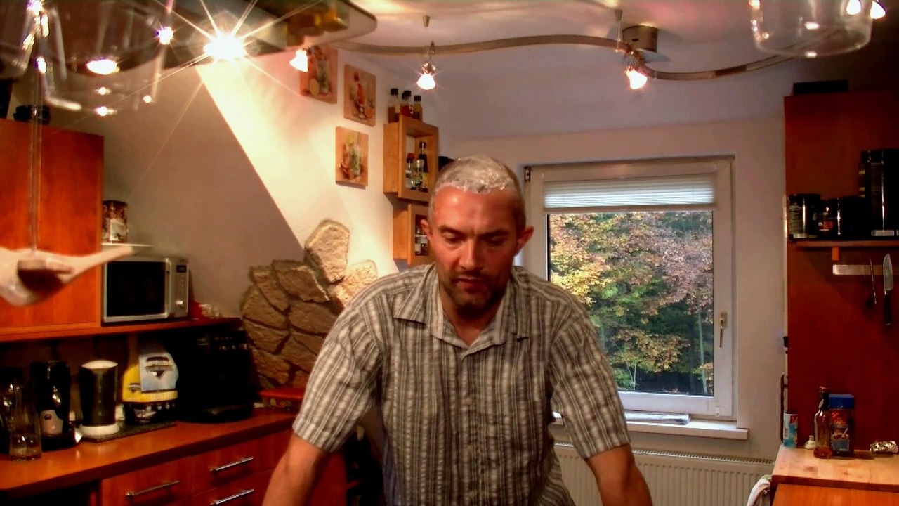 Teil 2 Haartransplantation einweichen der Haare und Ablauf Türkei Istanbul