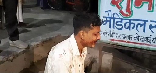 बाइक सवार का बिगड़ा संतुलन, गिरकर हुआ घायल