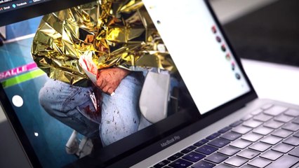 Témoignage d'Ameer al-Halbi, photographe syrien blessé lors de la manifestation à Paris