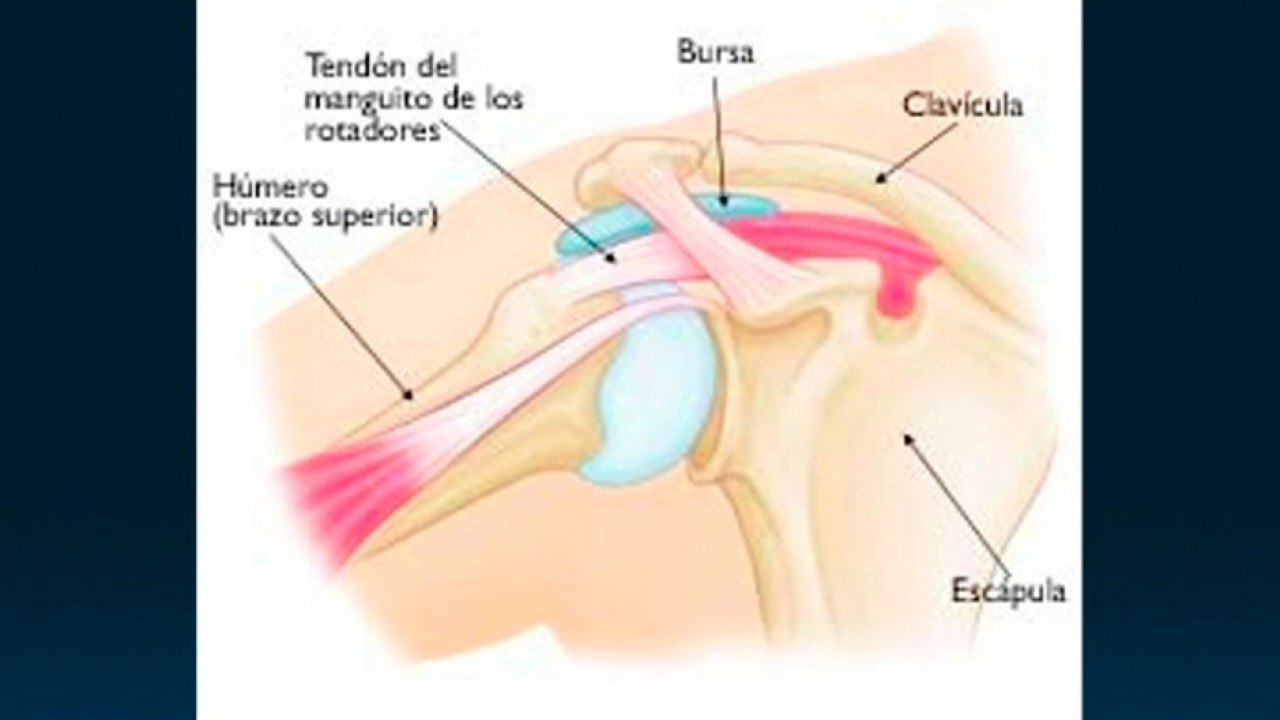 bd-ayuda-de-la-fisioterapia-en-lesiones-de-hombro-301120
