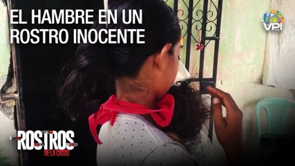 El Hambre de un Rostro Inocente - Rostros de la crisis - VPItv