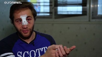 شاهد: مصور سوري يروي واقعة جرحه خلال مظاهرة في باريس