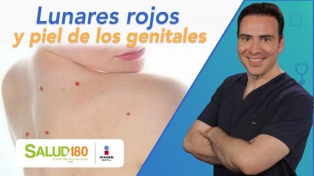 Dr. Salud | Lunares rojos y piel de los genitales | Salud 180
