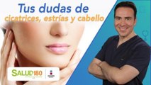 Dr. Salud | Estrías, cicatrices y cabello | Salud180