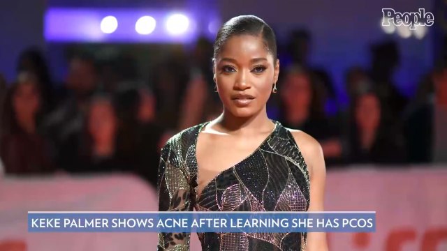 Keke Palmer Shows Her Acne After Learning She Has Polycystic Ovary Syndrome: ‘You’re Not Alone’