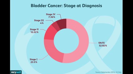 Treatment of Bladder Cancer by Stage