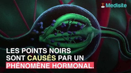 Point noir : comment se forme-t-il ?