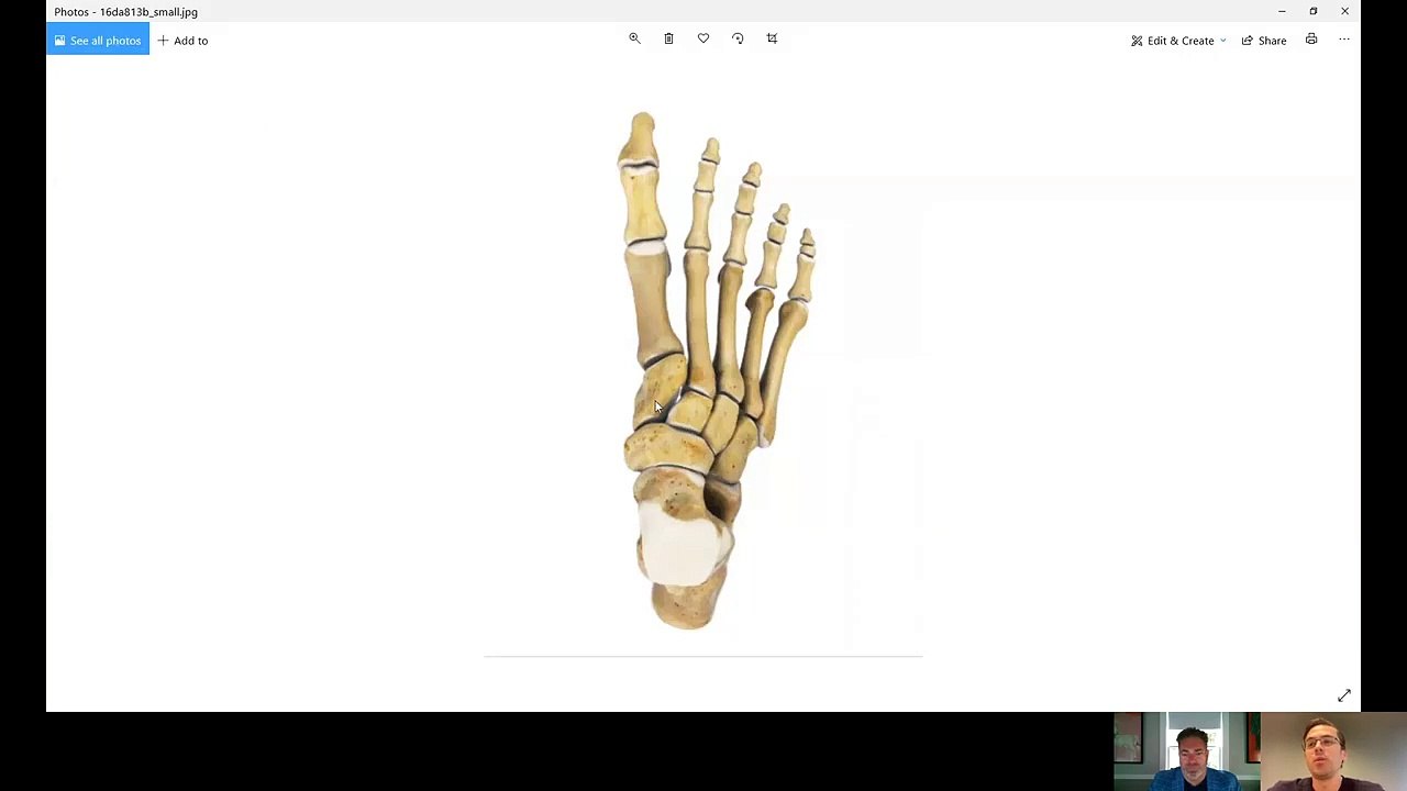 Joe Biden foot fracture - evaluation, treatment and implications for work of cuneiform fractures.