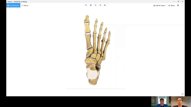 Joe Biden foot fracture - evaluation, treatment and implications for work of cuneiform fractures.