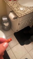 Having a Glass Eye Can Be a Neat Party Trick