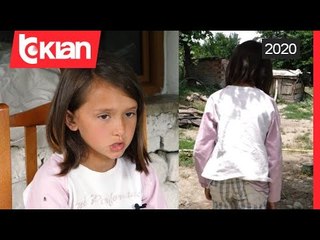 Historia e Fundjaves Xhesinda Sulmita ka nevoje per nderhyrje kirurgjikale