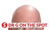 EP44: Correlation between baldness and virility? | PUTTING DR G ON THE SPOT