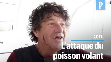 Vendée Globe : Jean Le Cam blessé au visage , percuté par un poisson volant