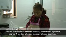La increíble historia de superación de Du Xuanmei, la profesora china que perdió sus manos y pies