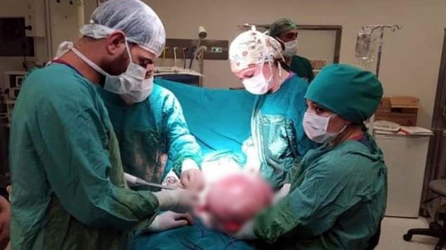 Ağrı şikayeti ile gitti, karnından 9 kilo 800 gram kitle çıkarıldı