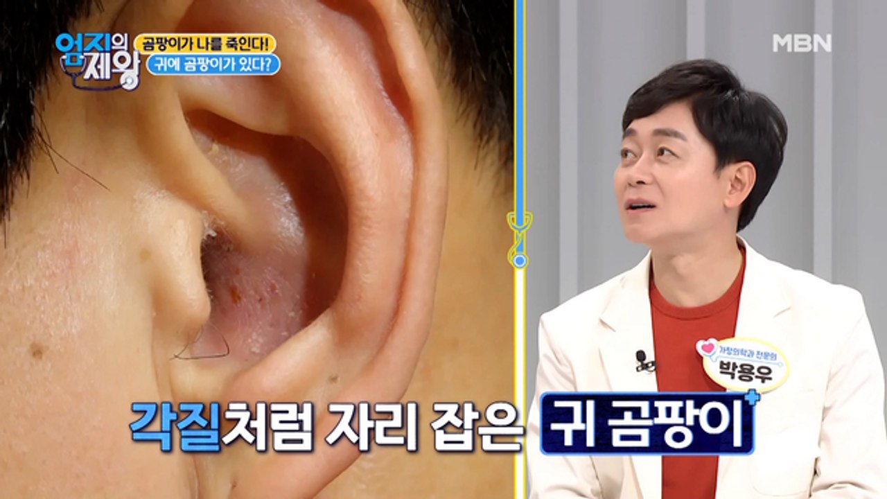 어느날 갑자기 귀에 곰팡이가 핀 이유는?