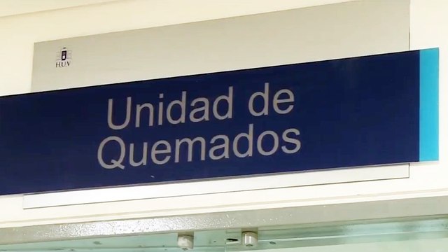 Lesionados con pólvora siguen llegando a los pabellones de quemados en todo el país