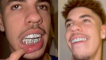 LaMelo Ball Ices Out His Mouth With 14k Gold Diamond Grill After Signing His Hornets Contract