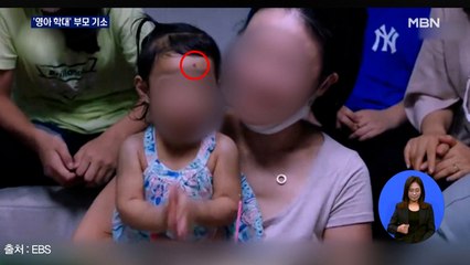 생후 16개월 영아 학대 부모 기소…"장기손상·온 몸 골절"